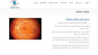 لقطة شاشة لموقع علاج انفصال الشبكية في مصر
بتاريخ 22/09/2019
بواسطة دليل مواقع موقعي